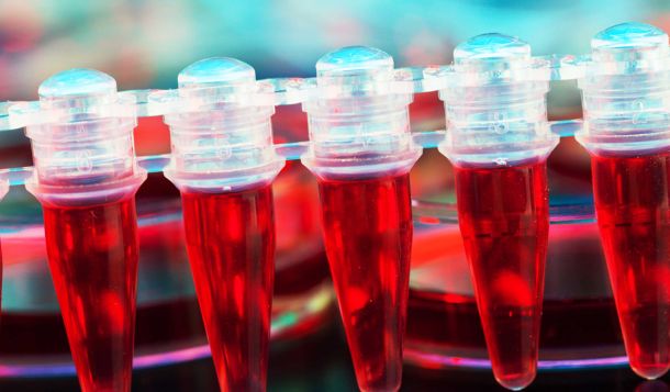 Zellen aus Eigenblut für Zahnfleisch